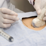interventional pain